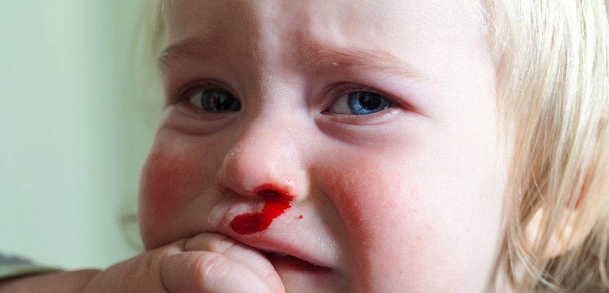 Santé. Mon enfant saigne du nez : que faire ? 
