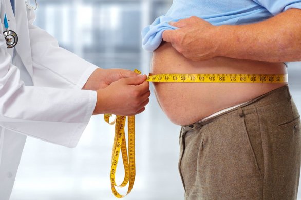 Santé. Qu’est-ce que l’obésité morbide ? 